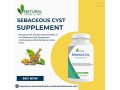 sebaceous-cyst-supplement-made-by-natural-herbs-clinic-small-0