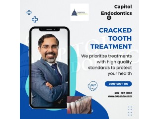 Specialized Cracked Tooth Treatment by Endodontists for Lasting Relief & Functionality