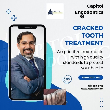 specialized-cracked-tooth-treatment-by-endodontists-for-lasting-relief-functionality-big-0