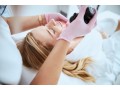 laser-skin-resurfacing-treatment-in-new-paltz-at-luna-dermatology-small-0