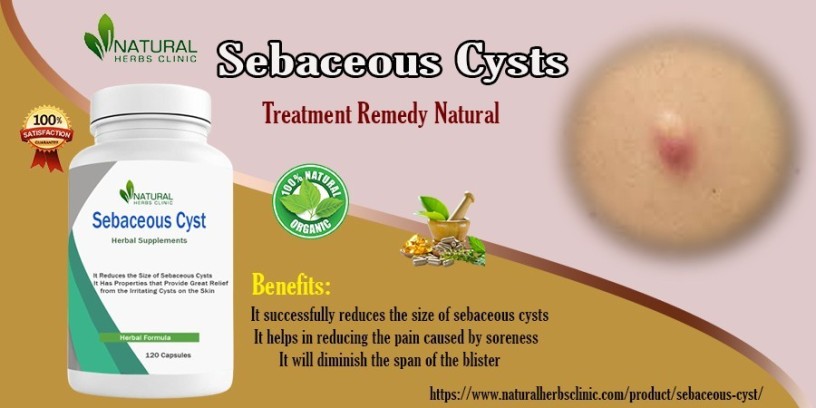 home-removal-of-sebaceous-cyst-big-0