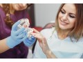 best-dental-treatment-to-improve-your-smile-at-elite-dental-small-1