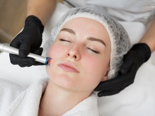 New Paltz and Kingston Laser Skin Resurfacing Treatment