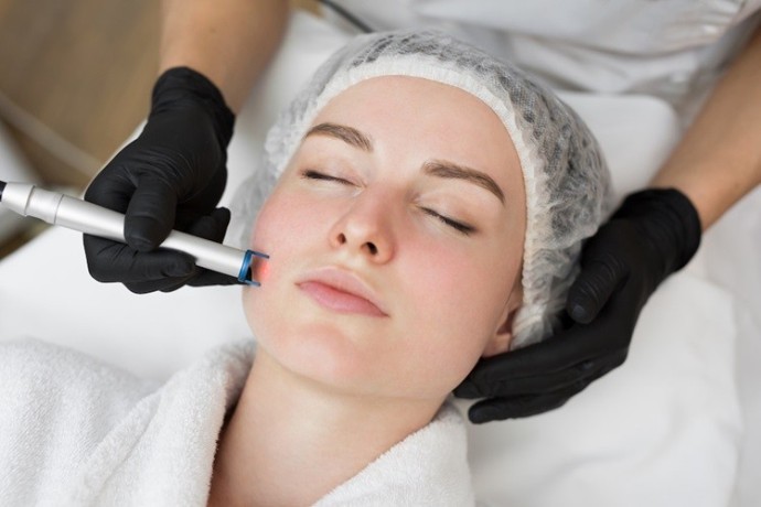 new-paltz-and-kingston-laser-skin-resurfacing-treatment-big-0