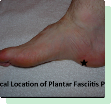 plantar-fasciitis-heel-pain-treatment-big-0