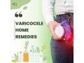 best-varicocele-treatment-a-natural-and-non-surgical-approach-with-homeopathy-small-0