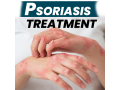 best-natural-scalp-psoriasis-treatment-no-steroids-needed-small-1