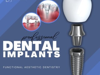 Experience Superior Dental Implant Solutions in Summerlin at Functional Aesthetic Dentistry