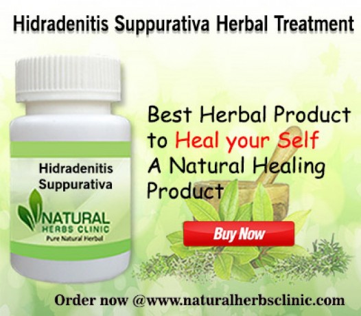 natural-remedies-for-hidradenitis-suppurativa-big-0