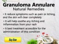 herbal-supplement-for-granuloma-annulare-small-0