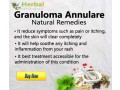 herbal-supplement-for-granuloma-annulare-small-0