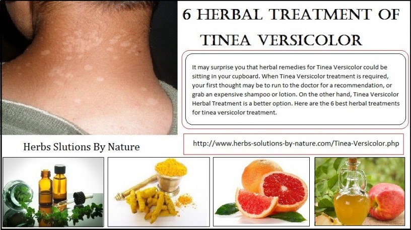 natural-remedies-for-tinea-versicolor-with-helpful-home-ingredients-big-0