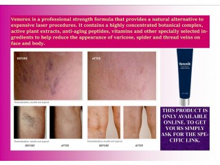 Diminish the appearance of varicose veins.