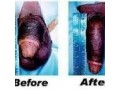 dominated-unmissable-27793478685-penis-enlargement-cream-pills-in-estcourt-ladysmith-winterton-dundee-greytown-small-0