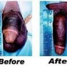 dominated-unmissable-27793478685-penis-enlargement-cream-pills-in-estcourt-ladysmith-winterton-dundee-greytown-big-0