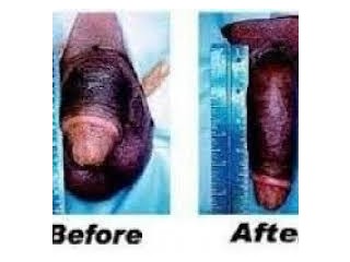 SWIFT growth ,27793478685 uppermost Penis Enlargement Cream and pills in St Lucia Ubombo Balgowan Boston Byrne Dargle Hilton swaziland